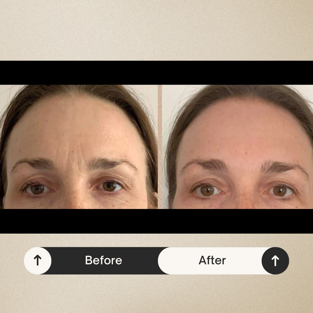 Side-by-side comparison of 'Before' and 'After' photos, showing changes or improvements in appearance and effectiveness of the LED mask